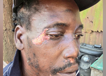 Nightclub Clash Lands ‘Horse’ Garnett Before Court