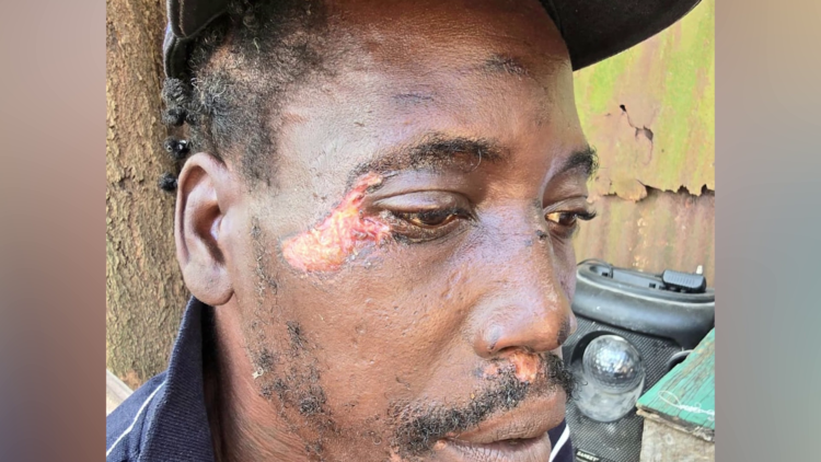 Nightclub Clash Lands ‘Horse’ Garnett Before Court