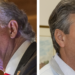 Trump Looms Over Pivotal Republican Senate Runoff in Georgia