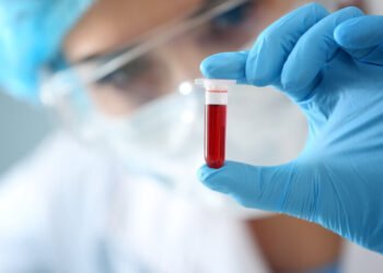 Dos and don’ts before a blood test: This can make a big difference in the results