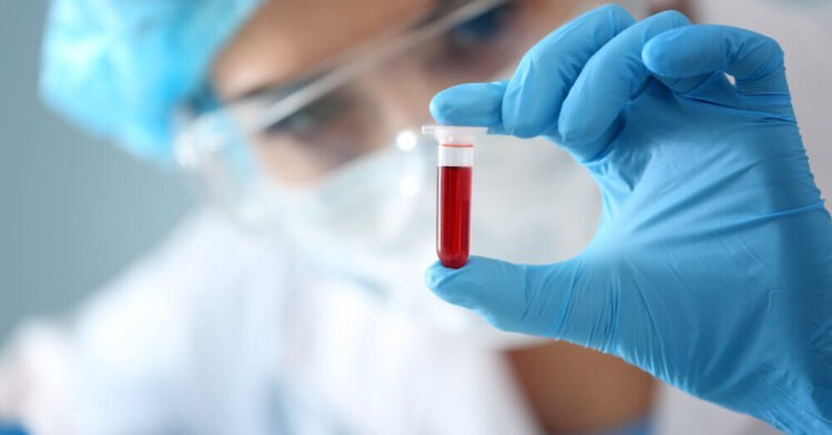 Dos and don’ts before a blood test: This can make a big difference in the results