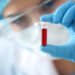 Dos and don’ts before a blood test: This can make a big difference in the results