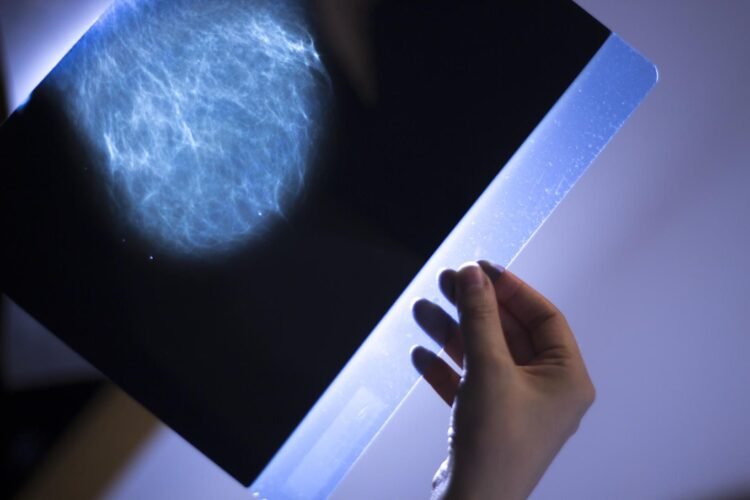 More people could escape chemotherapy