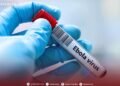 NCDC: No Ebola cases in Libya