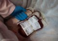 Project to avoid transfusion reduces infections in hospital – 06/14/2026 – Equilíbrio e Saúde