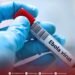 NCDC: No Ebola cases in Libya