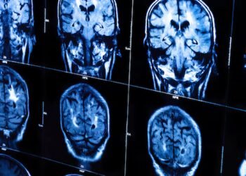 Women with traumatic brain injury 26 per cent less likely to receive trauma care than men, Ontario study finds
