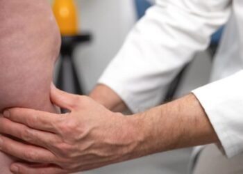 Lipedema: A little-known and underdiagnosed disease – Today Morocco