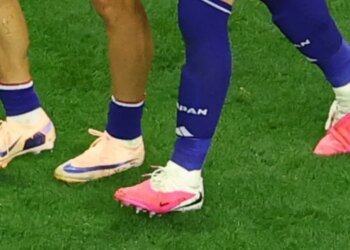Telex: Will the worn-out socks be the new fashion of the World Cup?