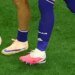 Telex: Will the worn-out socks be the new fashion of the World Cup?