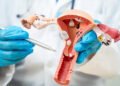 New less invasive treatments expand care options for women with endometriosis and fibroids