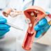New less invasive treatments expand care options for women with endometriosis and fibroids