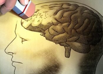 Thirty-year-olds complain of excessive forgetfulness. Is this normal?