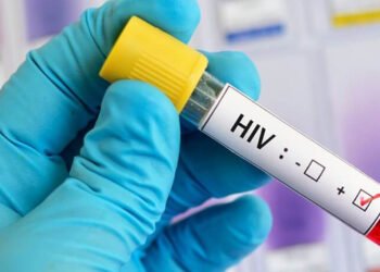 SVG sees spike in HIV among older men, young adults – iWitness News