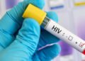 SVG sees spike in HIV among older men, young adults – iWitness News