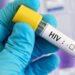 SVG sees spike in HIV among older men, young adults – iWitness News