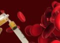 The Ministry of Health reveals details of the expansion of the service of therapeutic plasma exchange sessions using automated separation techniques for blood components.. It enhances the efficiency of treatment and reduces potential complications.. It saves patients with immune system and lupus erythematosus.