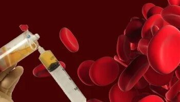 The Ministry of Health reveals details of the expansion of the service of therapeutic plasma exchange sessions using automated separation techniques for blood components.. It enhances the efficiency of treatment and reduces potential complications.. It saves patients with immune system and lupus erythematosus.