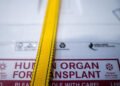 Liechtenstein is waiting for Switzerland’s organ donation reform