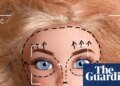 ‘The face doesn’t move’: Hollywood’s obsession with cosmetic surgeries has led to stiffer looks – and performances | Cosmetic surgery