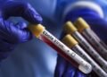 Congo reports more than 100 Ebola deaths