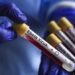Congo reports more than 100 Ebola deaths