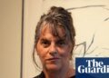 Doctors hail drug that spares bladder cancer patients ‘life-changing’ surgery | Cancer research