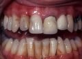Every puff leaves a scar: The hidden damage smoking, vaping, and marijuana cause to your mouth and body | Lifestyles