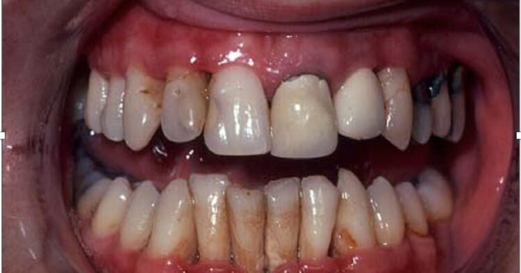 Every puff leaves a scar: The hidden damage smoking, vaping, and marijuana cause to your mouth and body | Lifestyles