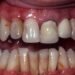 Every puff leaves a scar: The hidden damage smoking, vaping, and marijuana cause to your mouth and body | Lifestyles