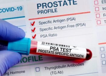 Before prostate cancer speaks, PSA often whispers | Lifestyles