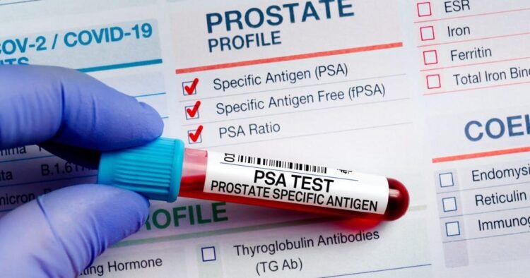 Before prostate cancer speaks, PSA often whispers | Lifestyles