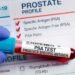 Before prostate cancer speaks, PSA often whispers | Lifestyles