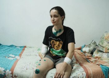 The rescuer told about the attack on Kharkiv, when she lost her arm