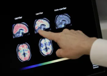 People are not as vulnerable to dementia as they think