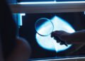 Test which spares breast cancer sufferers chemo not used enough