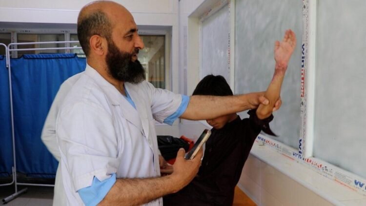 Afghan surgeon wins international award for fish-skin burn treatment – Pajhwok Afghan News
