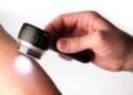 Free skin examinations on Wednesdays in front of the Municipality of Novi Beograd – Društvo