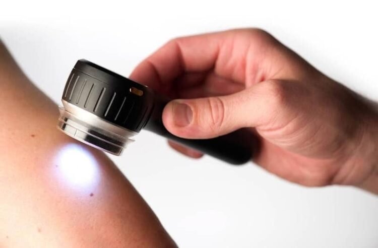 Free skin examinations on Wednesdays in front of the Municipality of Novi Beograd – Društvo