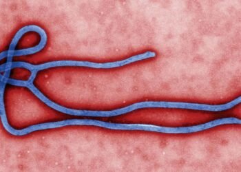 Saint Lucia updates Ebola preparedness plan as Caribbean strengthens border screening