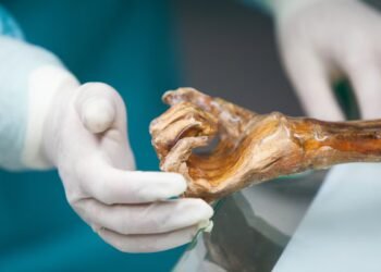 The microbes of Ötzi, the iceman, awaken thousands of years after his death | Science