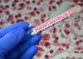 Scientist warns of possible climate link to hantavirus outbreaks