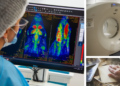 Uruguayan scientists take a key step to detect Alzheimer’s earlier with the first drug developed in the country