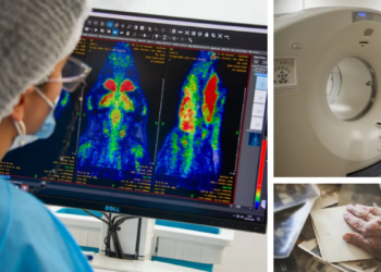 Uruguayan scientists take a key step to detect Alzheimer’s earlier with the first drug developed in the country