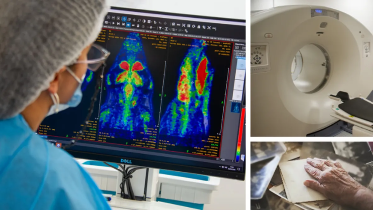 Uruguayan scientists take a key step to detect Alzheimer’s earlier with the first drug developed in the country