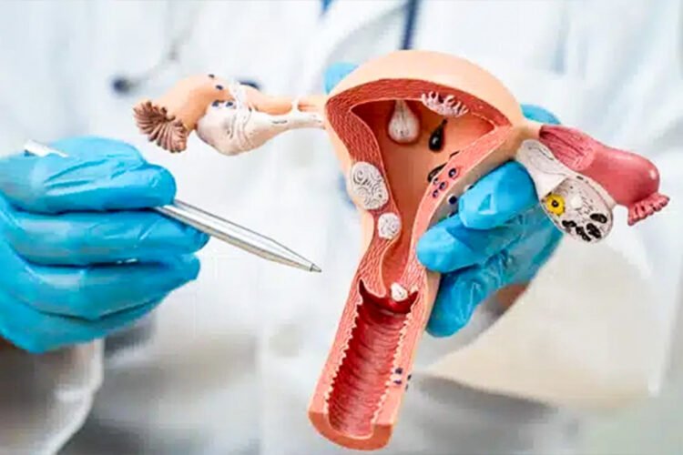 New less invasive treatments expand care options for women with endometriosis and fibroids