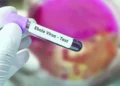 France: Recording the first case of Ebola