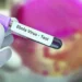 France: Recording the first case of Ebola
