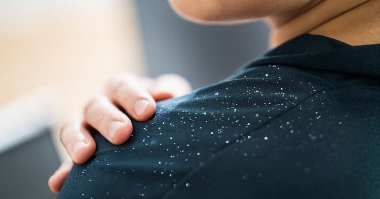 Struggling with a dry, itchy scalp this summer? Here’s how an anti-dandruff shampoo can help