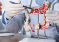 More young adults are being diagnosed with gastrointestinal cancers